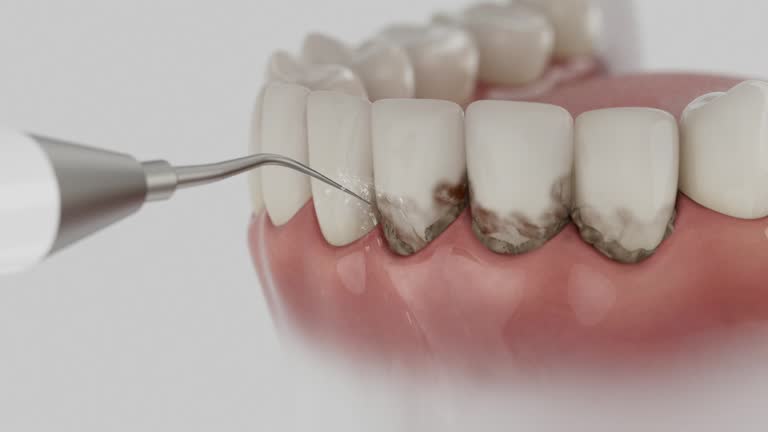 Reliable Dental contractor in Bargersville, IN by Dentist Open Now